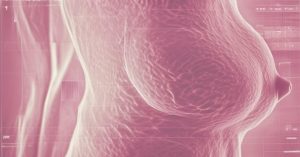 Diagnostyka raka piersi: Co powinnaś wiedzieć?