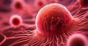 Niska hemoglobina nowotwór: Co powinnaś wiedzieć?